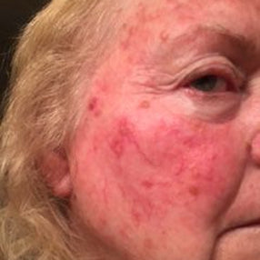 woman-b-n-a-after.jpg__PID:3ed75f9e-c138-4f87-a161-0af11b92754c