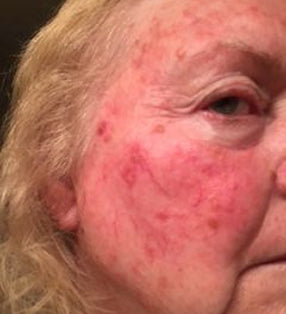 woman-b-n-a-after.jpg__PID:3ed75f9e-c138-4f87-a161-0af11b92754c