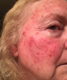 woman-b-n-a-after.jpg__PID:3ed75f9e-c138-4f87-a161-0af11b92754c